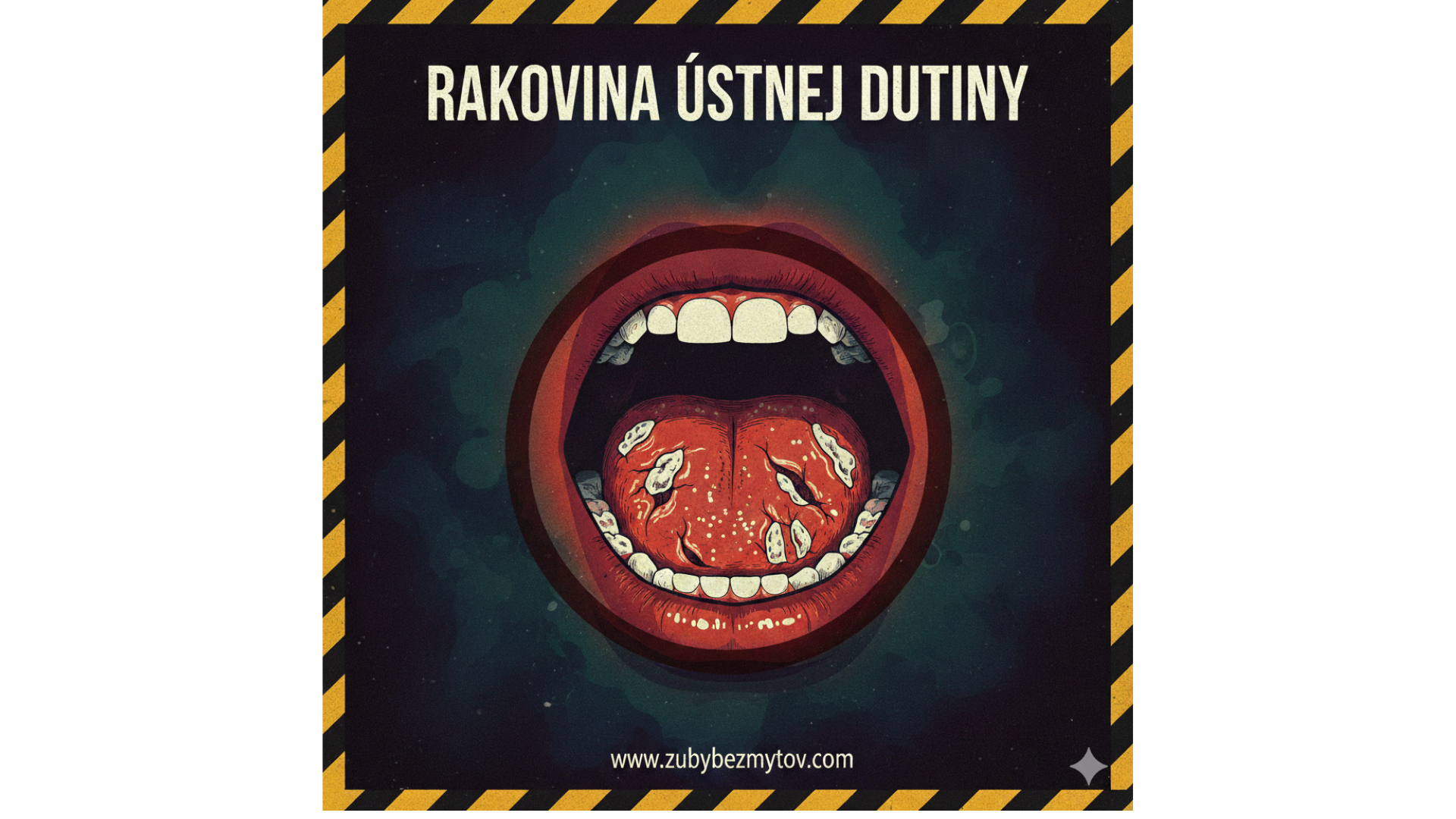 Rakovina ústnej dutiny