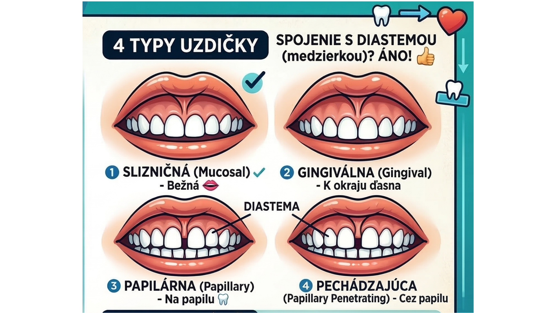 Uzdička hornej pery a jej terapia