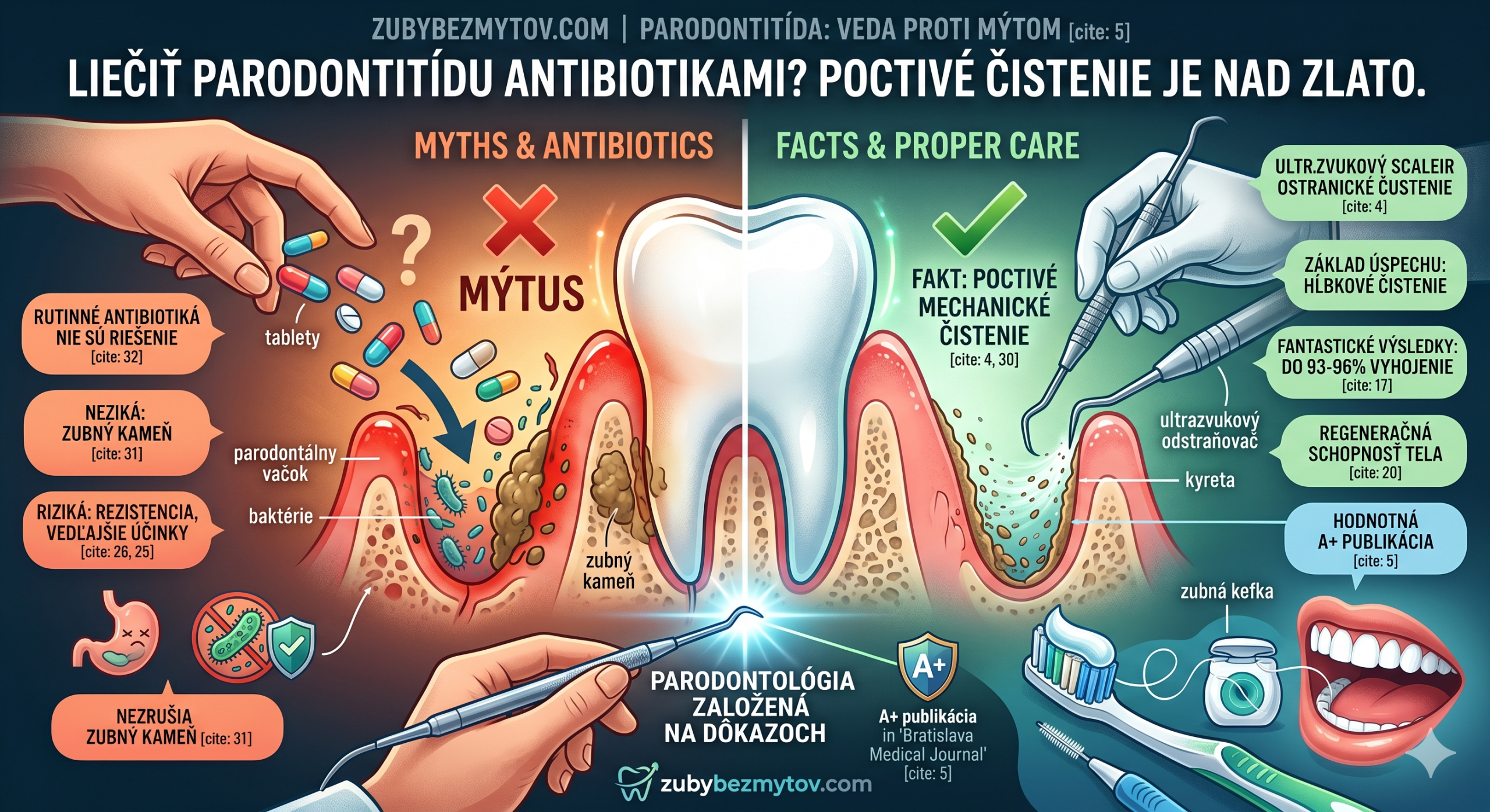 Liečiť parodontitídu antibiotikami?