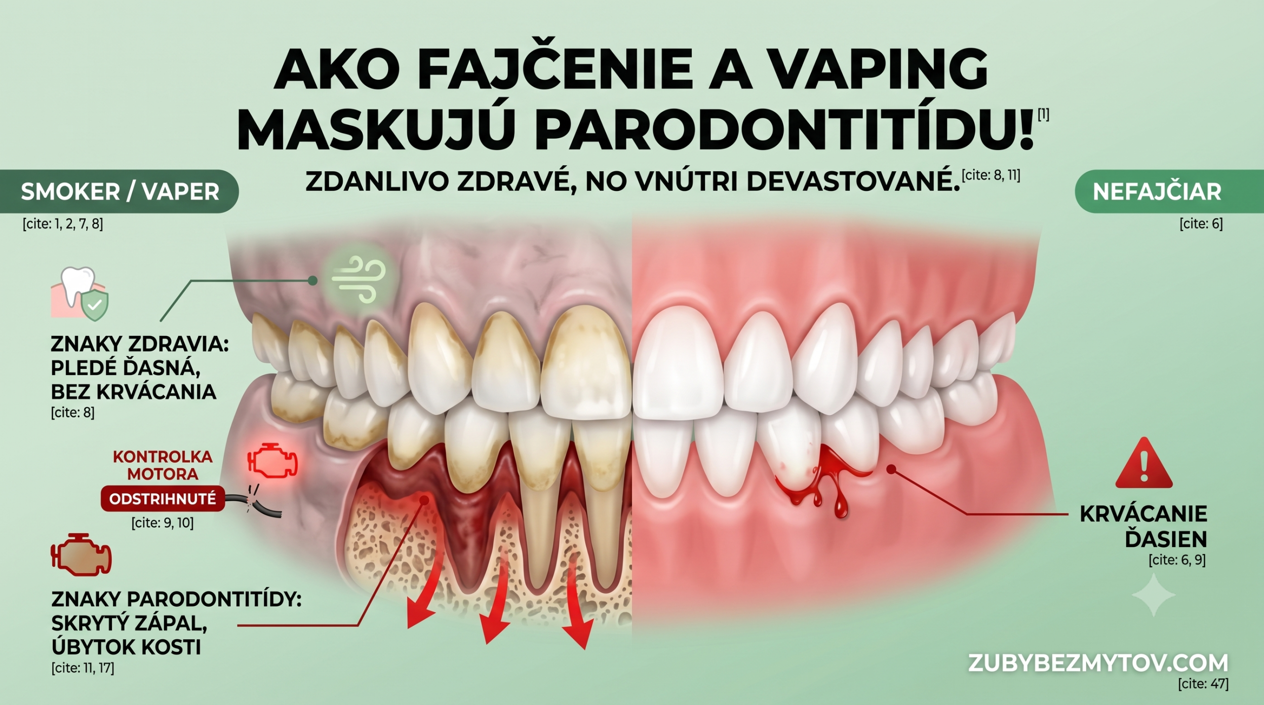 Ako fajčenie maskuje parodontitídu?